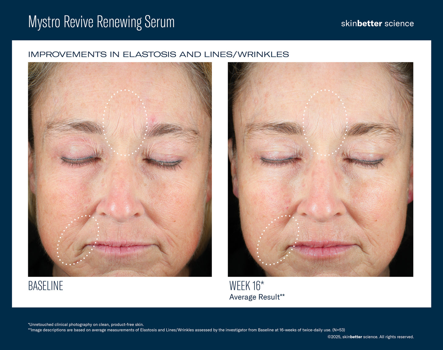 Mystro Revive Renewing Serum