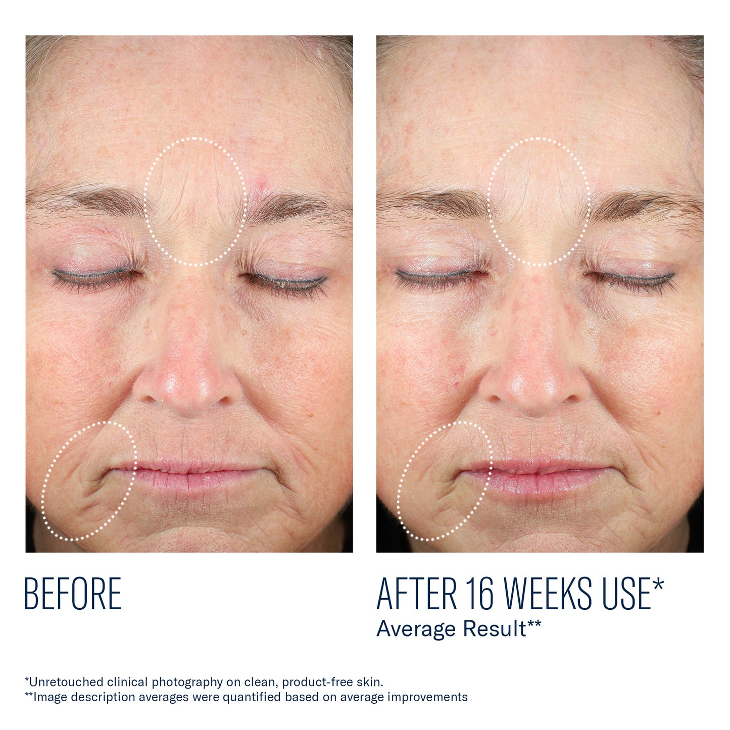 Mystro Revive Renewing Serum
