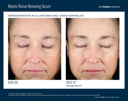 Mystro Revive Renewing Serum